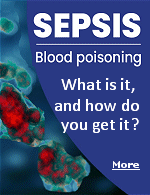Sepsis is a life-threatening illness that occurs when the body�s immune system attacks its very own tissues and organs in response to infection. Sepsis is caused by inflammation (swelling) throughout the body. During Sepsis, inflammation and blood clotting restrict blood flow to limbs and essential organs, which can lead to organ failure and death.